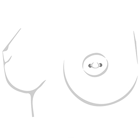 STANDARD NIPPLE