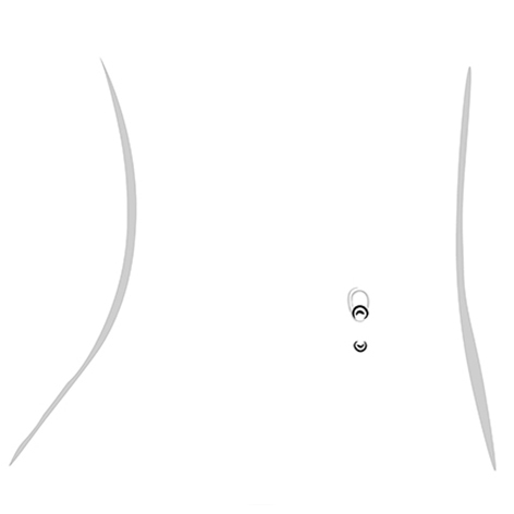 reverse navel