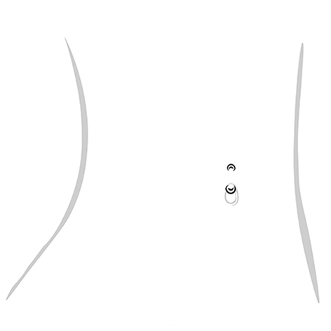 standard navel